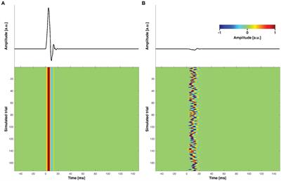 A simulation study: comparing independent component analysis and signal-space projection – source-informed reconstruction for rejecting muscle artifacts evoked by transcranial magnetic stimulation